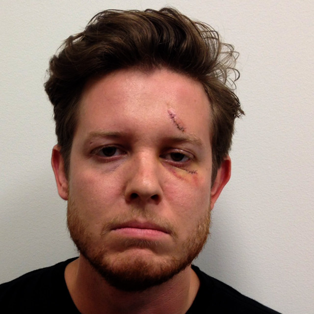 Image From Mervin’s Colbee Smooth Nearly Arrested For Excessive Smiling And Public Uncoordination After Incident At Portland Hotel